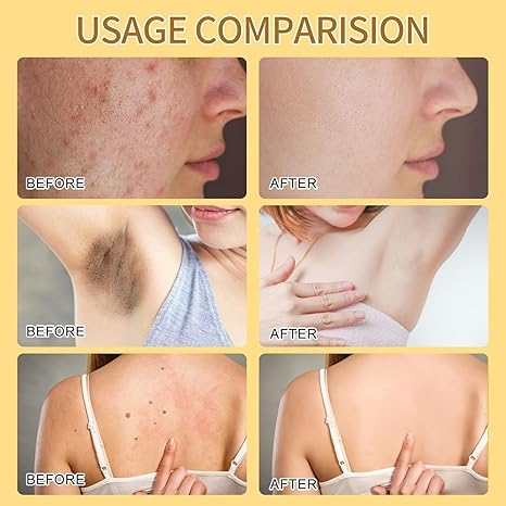 Bee Venom Cream – Natural Skin Care & Hydration