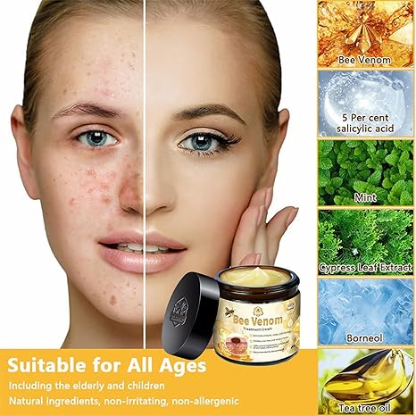 Bee Venom Cream – Natural Skin Care & Hydration