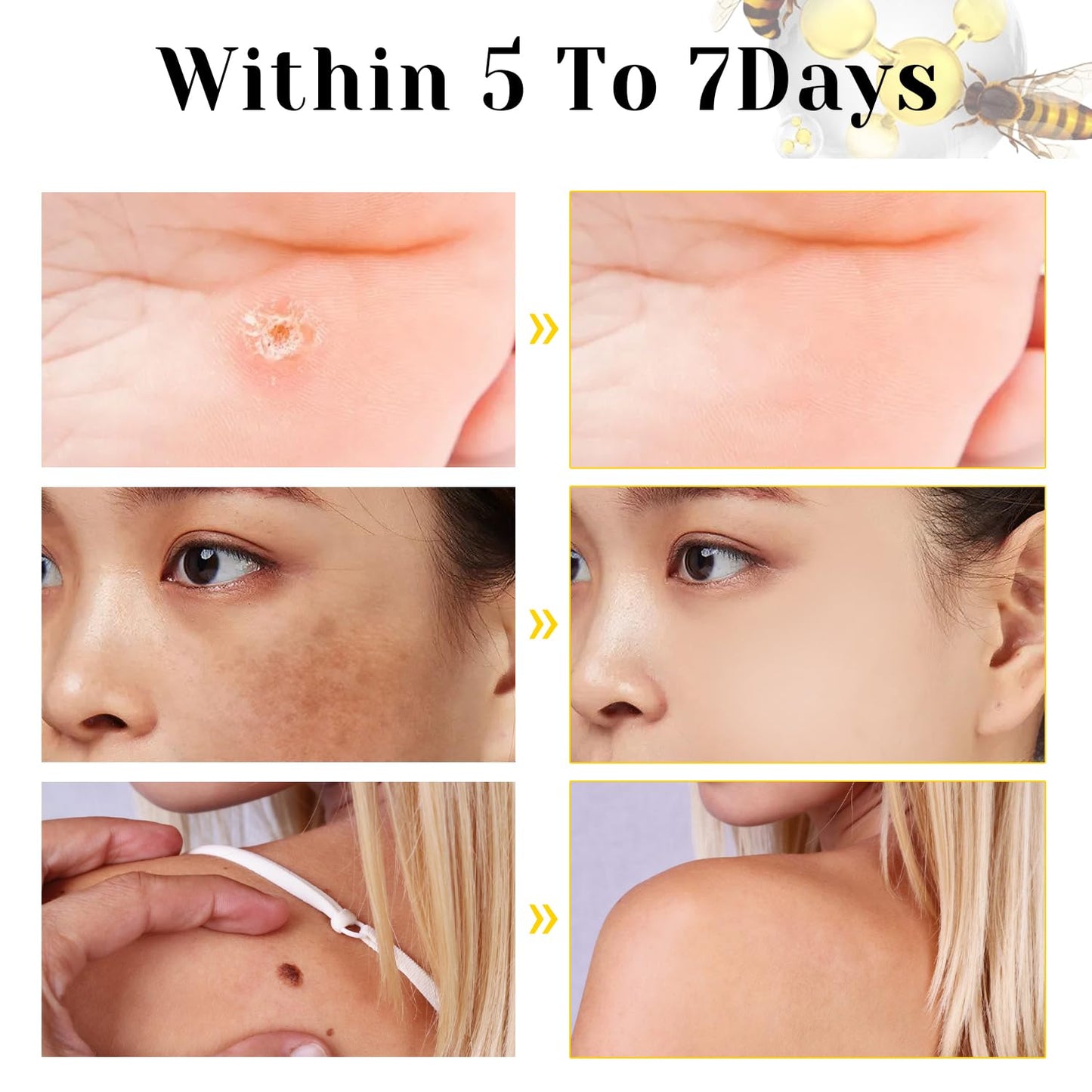 Bee Venom Cream – Natural Skin Care & Hydration