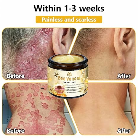 Bee Venom Cream – Natural Skin Care & Hydration