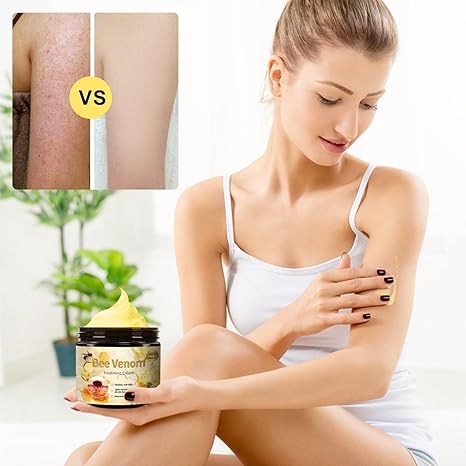 Bee Venom Cream – Natural Skin Care & Hydration
