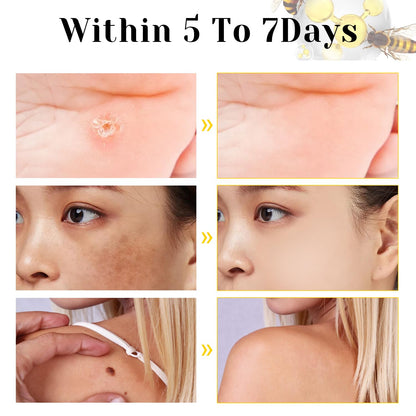 Bee Venom Cream – Natural Skin Care & Hydration